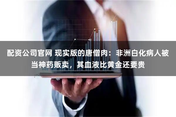配资公司官网 现实版的唐僧肉：非洲白化病人被当神药贩卖，其血液比黄金还要贵